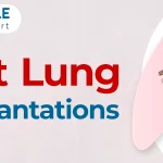 Dr. Alla Gopala Krishna Gokhale heart and lung transplantation surgery