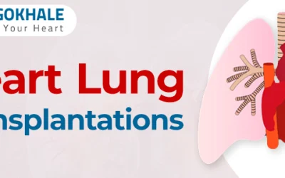 Heart Lung Transplantations | Dr Alla Gopala Krishna Gokhale